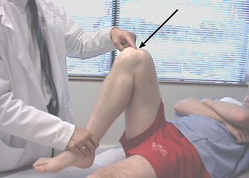 الألم في الركبة أثناء الانثناء هو السبب الأكثر شيوعًا لزيارة الأشخاص لأطباء الصدمة. 