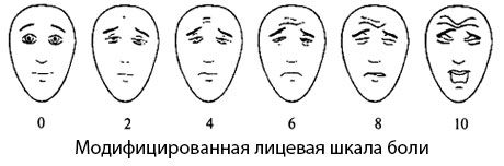 مقياس ألم الوجه المعدل